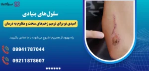 سلول های بنیادی برای ترمیم زخم