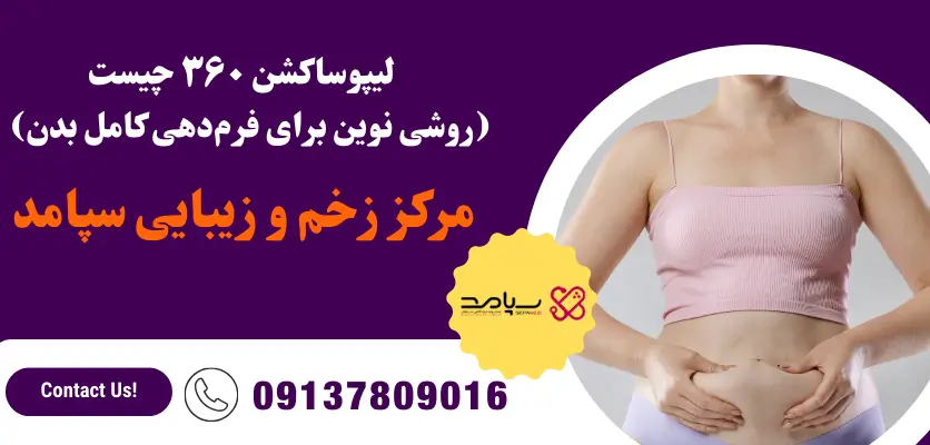 لیپوساکشن 360 چیست