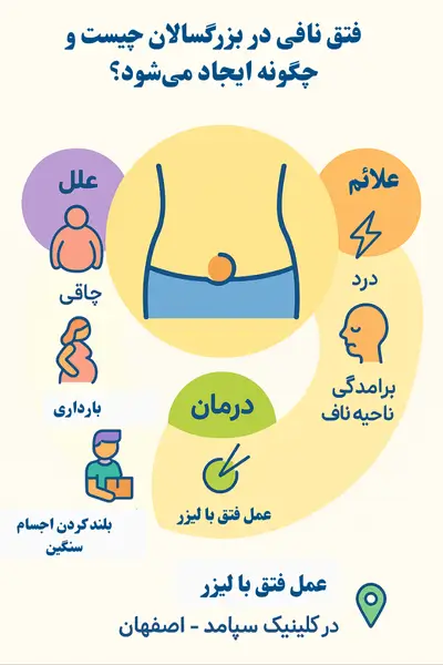 فتق نافی در بزرگسالان چیست