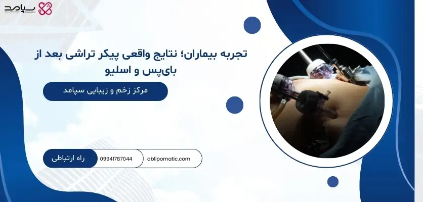 تجربه بیماران؛ نتایج واقعی پیکر تراشی بعد از بای_پس و اسلیو