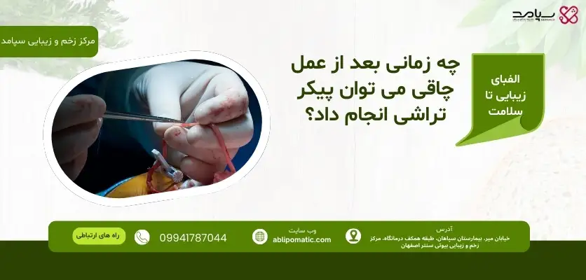 چه زمانی بعد از عمل چاقی می _توان پیکر تراشی انجام داد؟