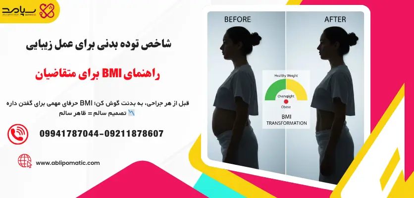 شاخص توده بدنی برای عمل زیبایی