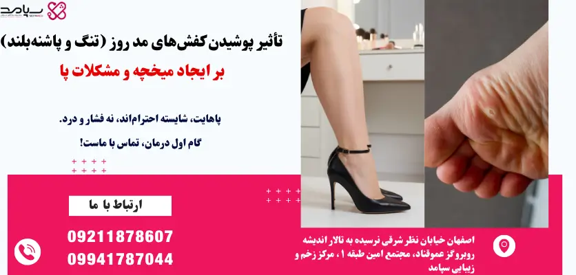 علت میخچه در اثر کفش تنگ