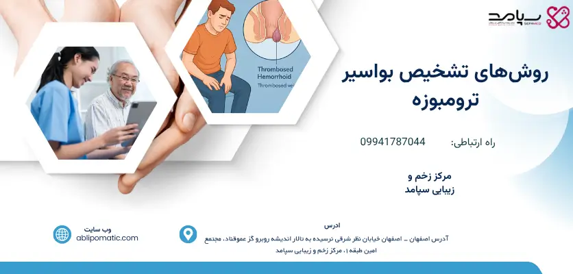 روشهای تشخیص بواسیر ترومبوزه