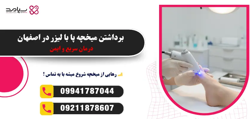 برداشتن میخچه با لیزر در اصفهان