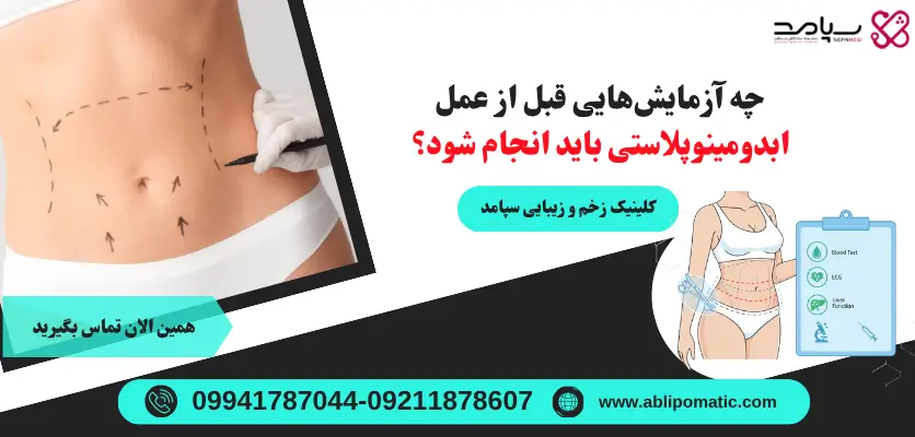 آزمایش قبل از عمل ابدومینوپلاستی