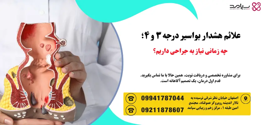 علائم بواسیر پیشرفته