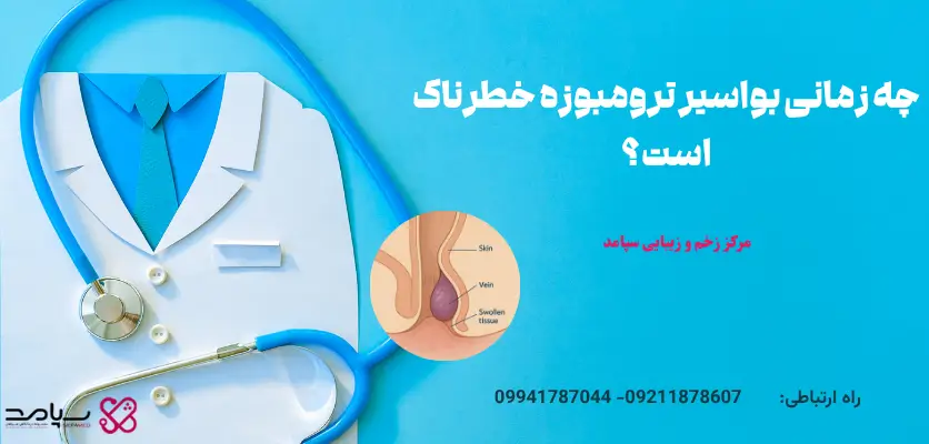چه زمانی بواسیر ترومبوزه خطرناک است؟