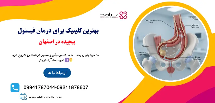 بهترین کلینیک برای درمان فیستول پیچیده