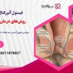 فیستول آنورکتال پیچیده
