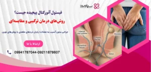 فیستول آنورکتال پیچیده