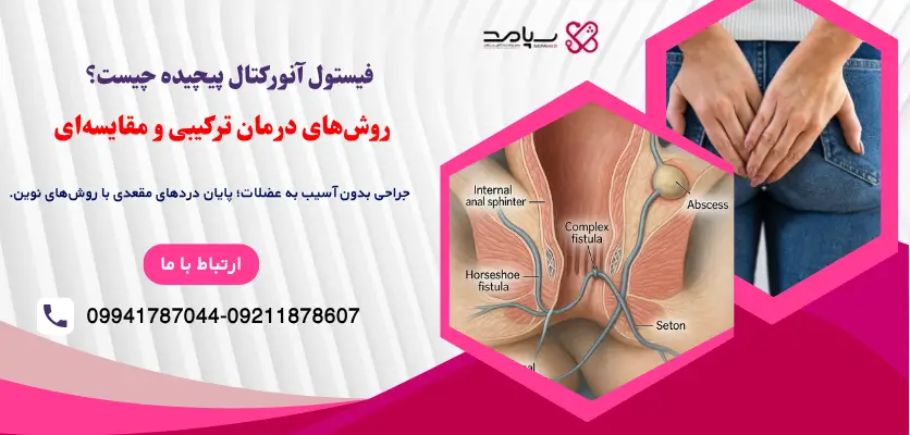 فیستول آنورکتال پیچیده