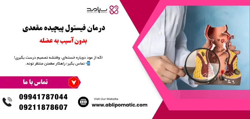 درمان فیستول پیچیده